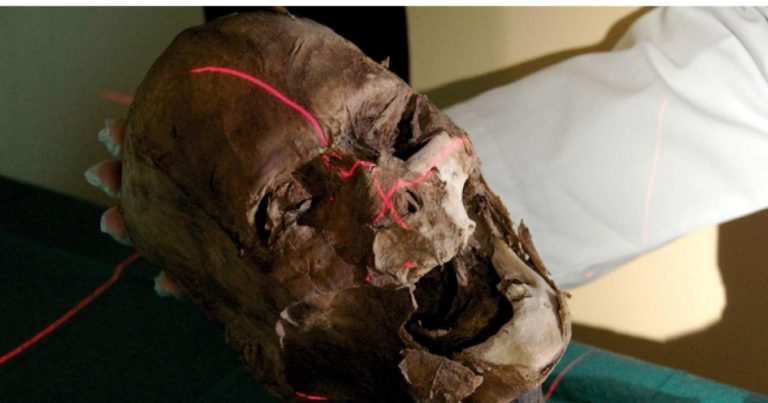 Le crâne identifié comme étant celui d'Henri IV par Philippe Charlier. (Photo DR)